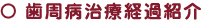 歯周病治療経過紹介